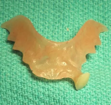 Partial denture by Dental Implant Pro