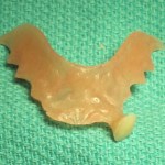 Partial denture by Dental Implant Pro